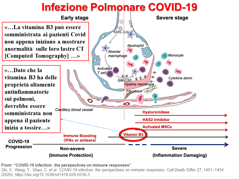Infezione polmonare COVID-19